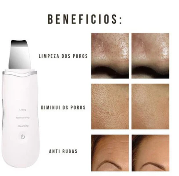 Aparelho de Peeling Ultra Sônico Portátil