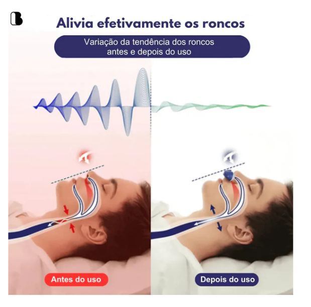 Anti Ronco Eletrônico Micro